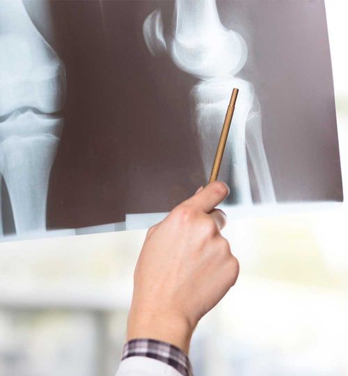 Radiografía de Rodilla Derecha