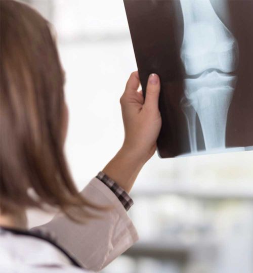 Radiografía de Rodilla Izquierda