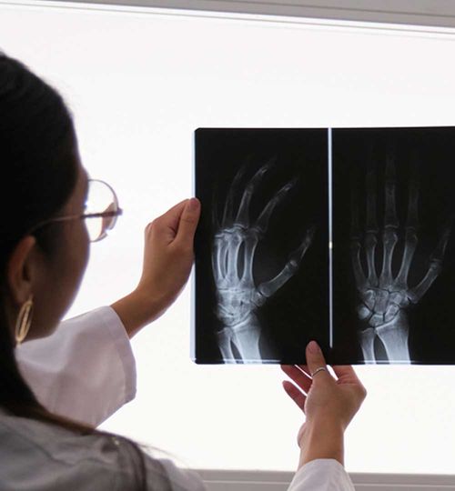 Radiografía de Edad Ósea (Carpograma)
