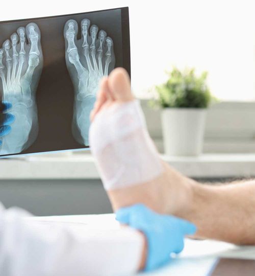 Radiografía de Pie Derecho