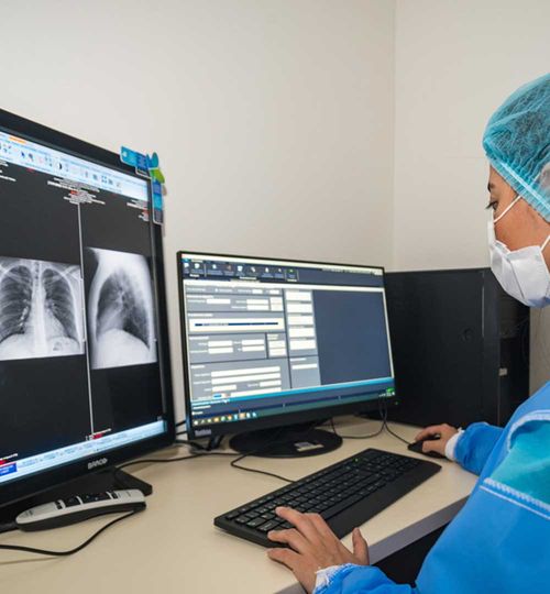 Radiografia Panoramica de Miembros Inferiores (Goniometria u Ortograma) en Formato 14"" X 36"" (Adultos)