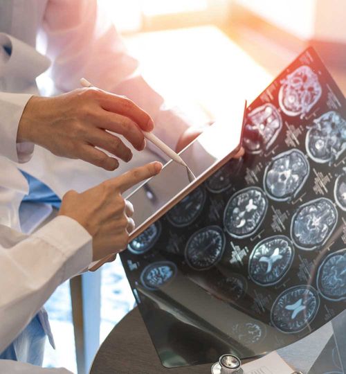 TAC de Anteversion Femoral Izquierda